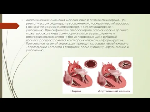 Анатомичсекие изменения клапана зависят от этиологии порока. При ревматичексом эндокардите воспалительно