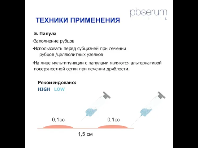 5. Папула Заполнение рубцов Использовать перед субцизией при лечении рубцов /целлюлитных