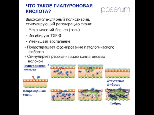 ЧТО ТАКОЕ ГИАЛУРОНОВАЯ КИСЛОТА? Высокомолекулярный полисахарид, стимулирующий регенерацию ткани: - Механический