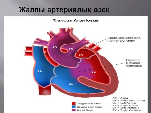 Жалпы артериялық өзек