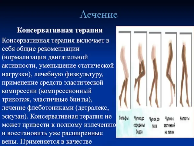 Лечение Консервативная терапия Консервативная терапия включает в себя общие рекомендации (нормализация