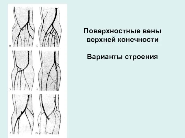 Поверхностные вены верхней конечности Варианты строения