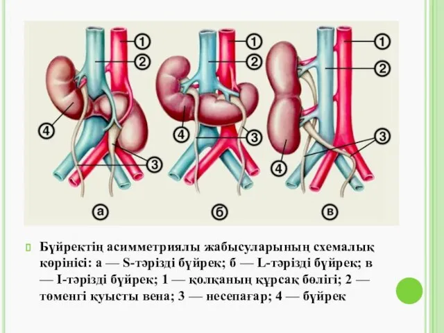 Бүйректің асимметриялы жабысуларының схемалық көрінісі: а — S-тәрізді бүйрек; б —