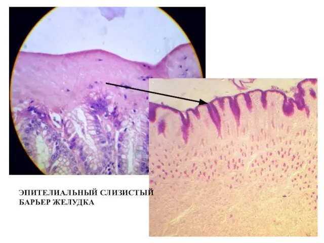 ЭПИТЕЛИАЛЬНЫЙ СЛИЗИСТЫЙ БАРЬЕР ЖЕЛУДКА