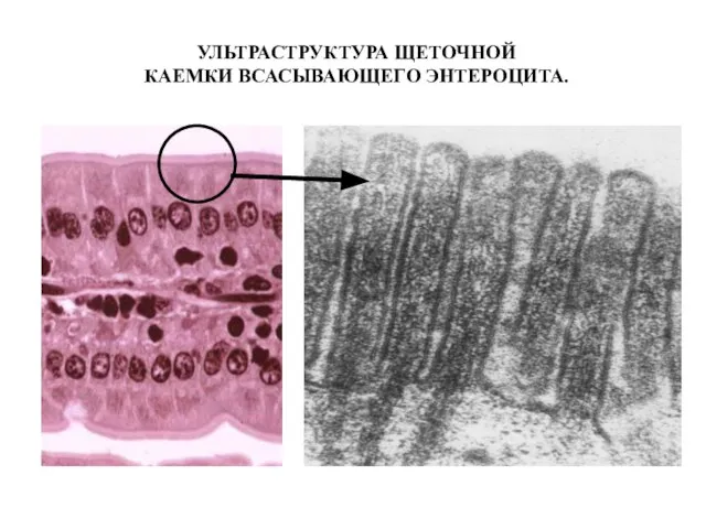 УЛЬТРАСТРУКТУРА ЩЕТОЧНОЙ КАЕМКИ ВСАСЫВАЮЩЕГО ЭНТЕРОЦИТА.