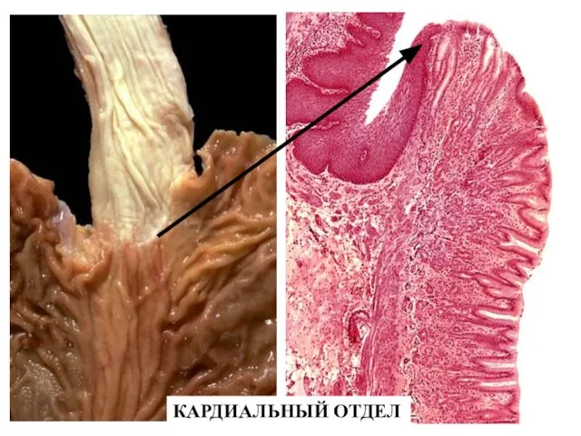 КАРДИАЛЬНЫЙ ОТДЕЛ