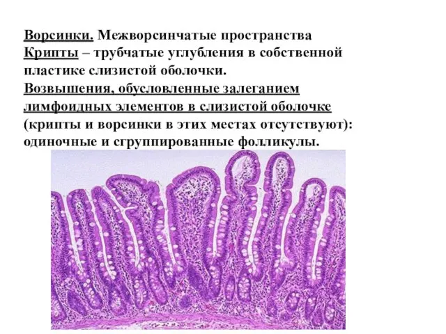 Ворсинки. Межворсинчатые пространства Крипты – трубчатые углубления в собственной пластике слизистой
