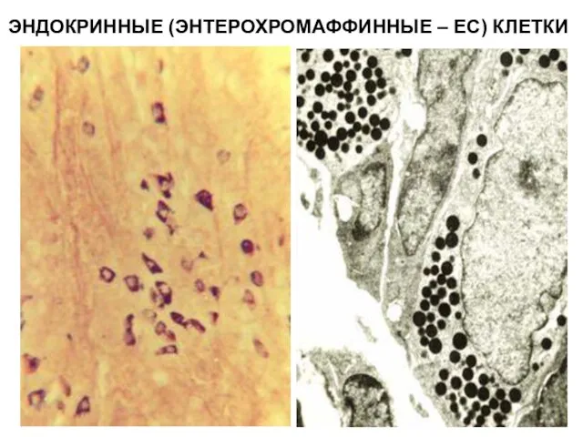 ЭНДОКРИННЫЕ (ЭНТЕРОХРОМАФФИННЫЕ – ЕС) КЛЕТКИ