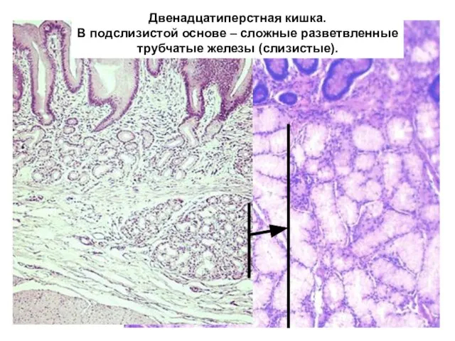 Двенадцатиперстная кишка. В подслизистой основе – сложные разветвленные трубчатые железы (слизистые).