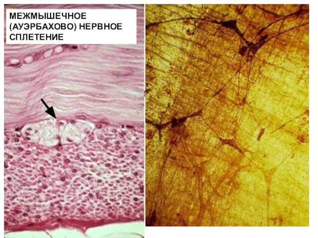 МЕЖМЫШЕЧНОЕ (АУЭРБАХОВО) НЕРВНОЕ СПЛЕТЕНИЕ