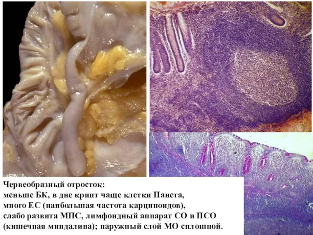 Червеобразный отросток: меньше БК, в дне крипт чаще клетки Панета, много