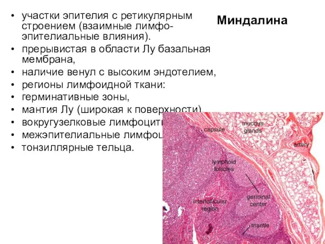 Миндалина участки эпителия с ретикулярным строением (взаимные лимфо-эпителиальные влияния). прерывистая в