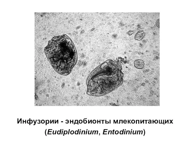 Инфузории - эндобионты млекопитающих (Eudiplodinium, Entodinium)