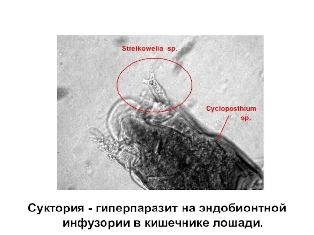 Суктория - гиперпаразит на эндобионтной инфузории в кишечнике лошади.