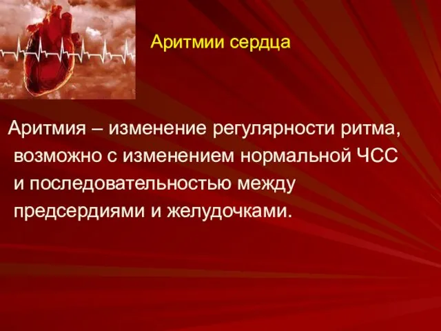 Аритмии сердца Аритмия – изменение регулярности ритма, возможно с изменением нормальной