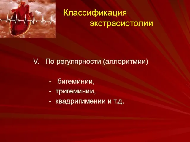 Классификация экстрасистолии V. По регулярности (аллоритмии) - бигеминии, - тригеминии, - квадригимении и т.д.