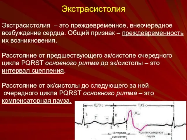 Экстрасистолия Экстрасистолия – это преждевременное, внеочередное возбуждение сердца. Общий признак –