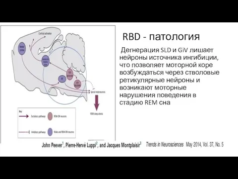 RBD - патология Дегнерация SLD и GiV лишает нейроны источника ингибиции,