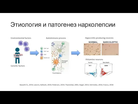 Этиология и патогенез нарколепсии