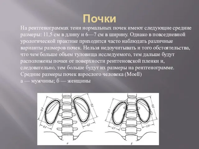 Почки На рентгенограммах тени нормальных почек имеют следующие средние размеры: 11,5