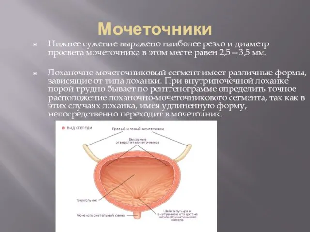 Мочеточники Нижнее сужение выражено наиболее резко и диаметр просвета мочеточника в