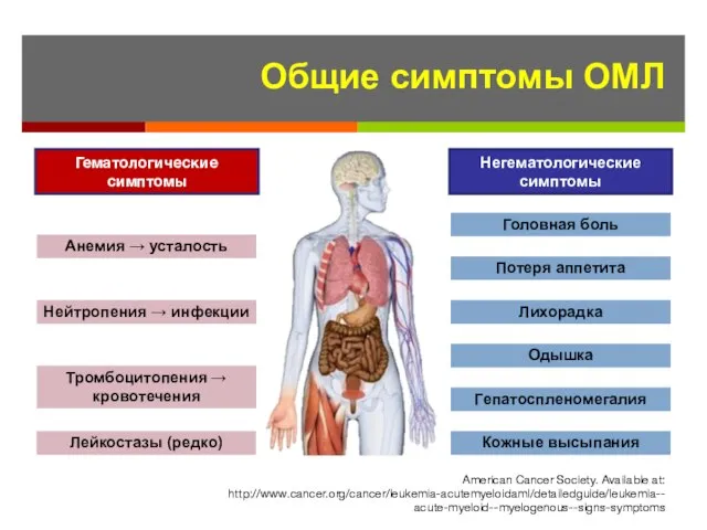 Общие симптомы ОМЛ American Cancer Society. Available at: http://www.cancer.org/cancer/leukemia-acutemyeloidaml/detailedguide/leukemia--acute-myeloid--myelogenous--signs-symptoms