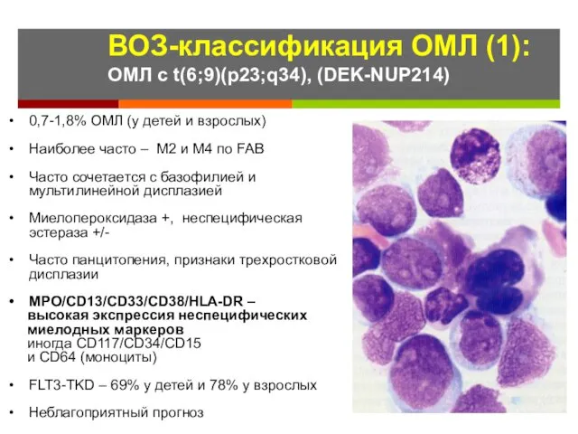 0,7-1,8% ОМЛ (у детей и взрослых) Наиболее часто – М2 и