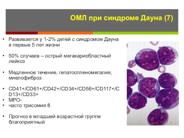 ОМЛ при синдроме Дауна (7) Развивается у 1-2% детей с синдромом