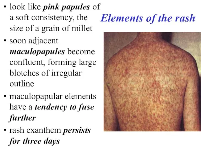 Elements of the rash look like pink papules of a soft