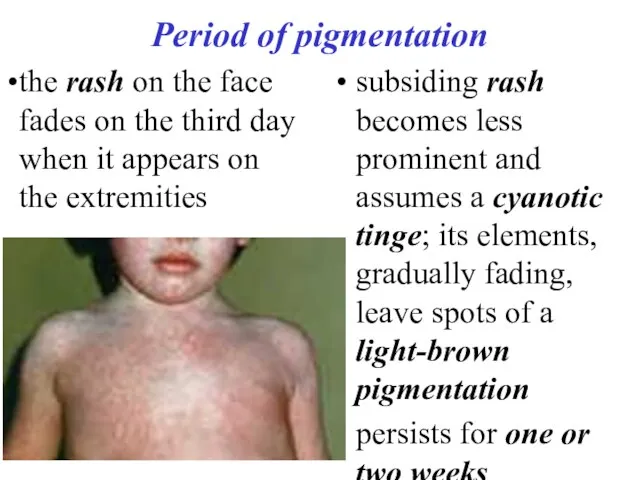 Period of pigmentation subsiding rash becomes less prominent and assumes a