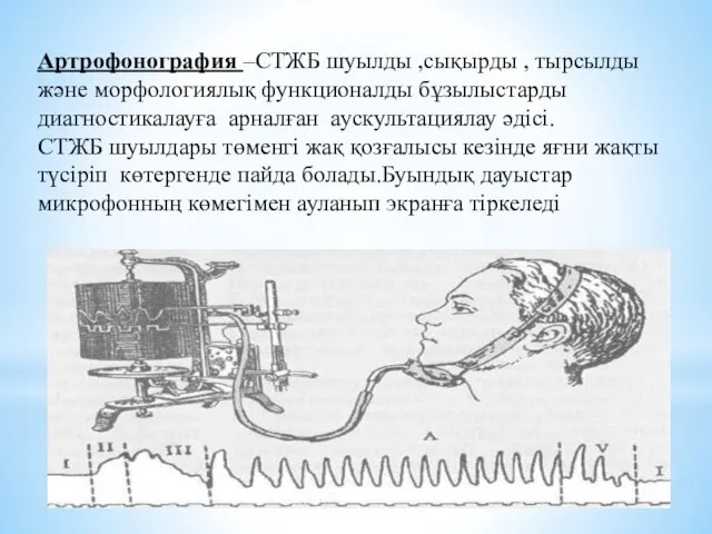 Артрофонография –СТЖБ шуылды ,сықырды , тырсылды және морфологиялық функционалды бұзылыстарды диагностикалауға