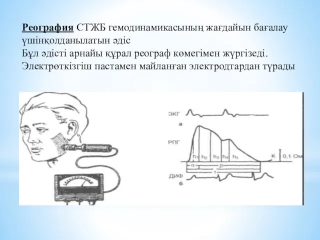 Реография СТЖБ гемодинамикасының жағдайын бағалау үшінқолданылатын әдіс Бұл әдісті арнайы құрал