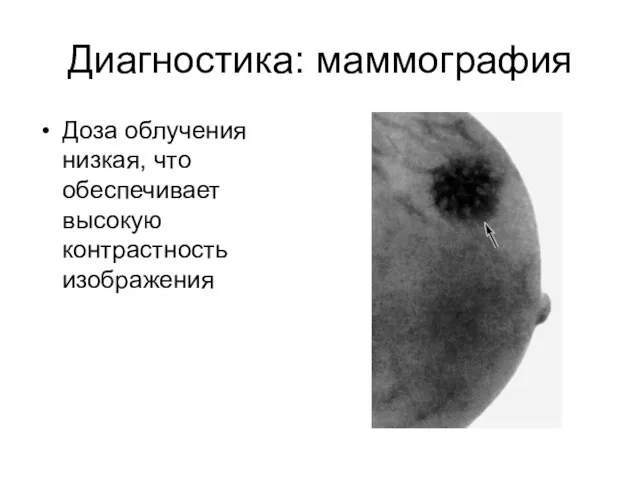 Диагностика: маммография Доза облучения низкая, что обеспечивает высокую контрастность изображения