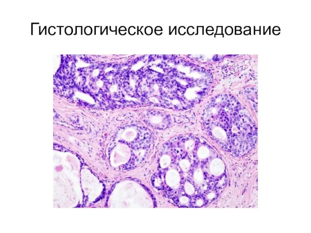 Гистологическое исследование