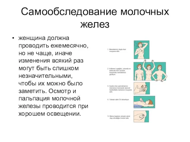 Самообследование молочных желез женщина должна проводить ежемесячно, но не чаще, иначе