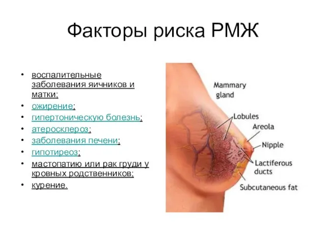 Факторы риска РМЖ воспалительные заболевания яичников и матки; ожирение; гипертоническую болезнь;