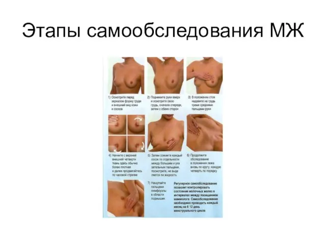 Этапы самообследования МЖ