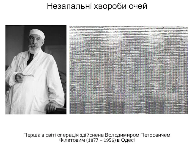 Незапальні хвороби очей Перша в світі операція здійснена Володимиром Петровичем Філатовим (1877 – 1956) в Одесі