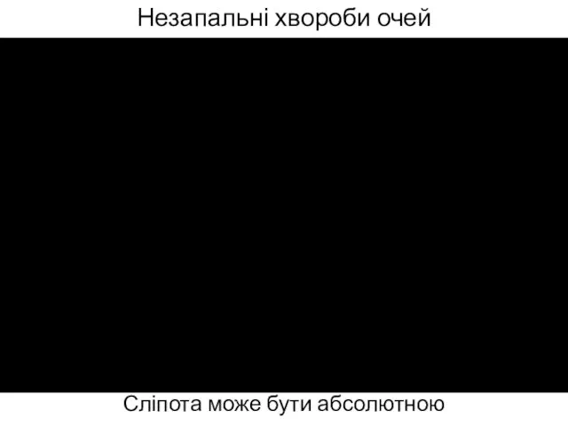 Незапальні хвороби очей Сліпота може бути абсолютною