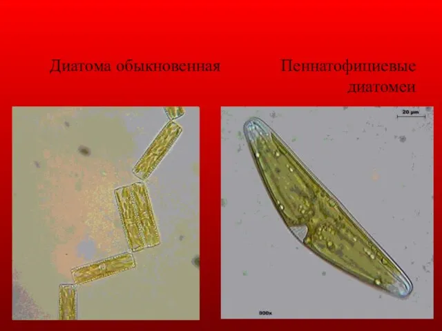 Диатома обыкновенная Пеннатофициевые диатомеи