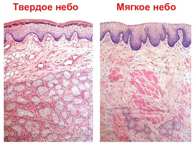 Твердое небо Мягкое небо