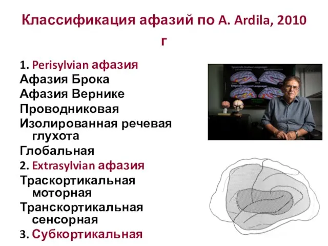 Классификация афазий по A. Ardila, 2010 г 1. Perisylvian афазия Афазия