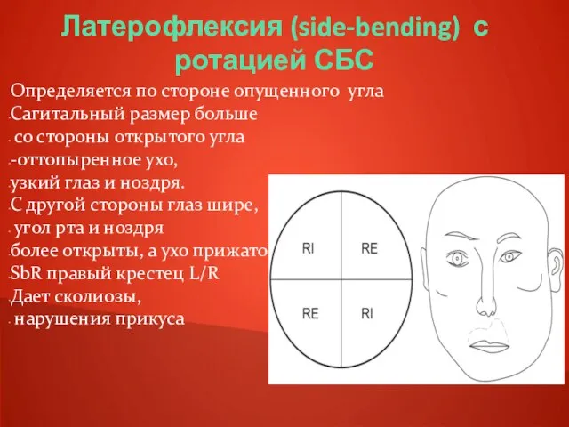 Латерофлексия (side-bending) с ротацией СБС Определяется по стороне опущенного угла Сагитальный