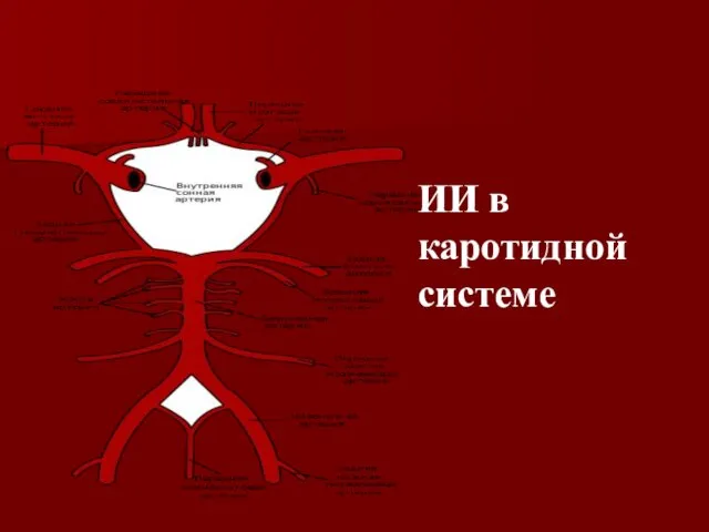 ИИ в каротидной системе