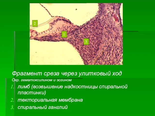 Фрагмент среза через улитковый ход Окр. гематоксилином и эозином лимб (возвышение