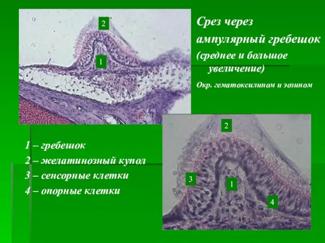 Срез через ампулярный гребешок (среднее и большое увеличение) 1 1 2
