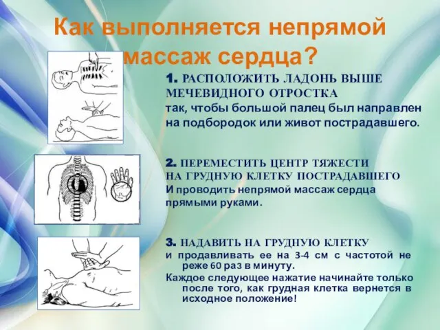 Как выполняется непрямой массаж сердца? 3. НАДАВИТЬ НА ГРУДНУЮ КЛЕТКУ и