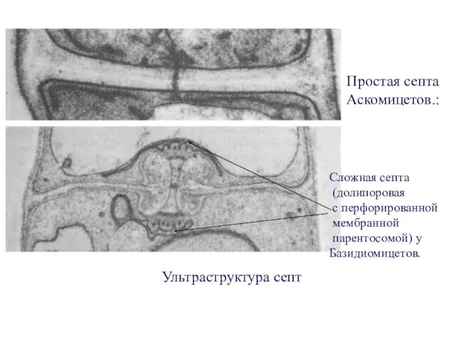 Ультраструктура септ Простая септа Аскомицетов.: Сложная септа (долипоровая с перфорированной мембранной парентосомой) у Базидиомицетов.