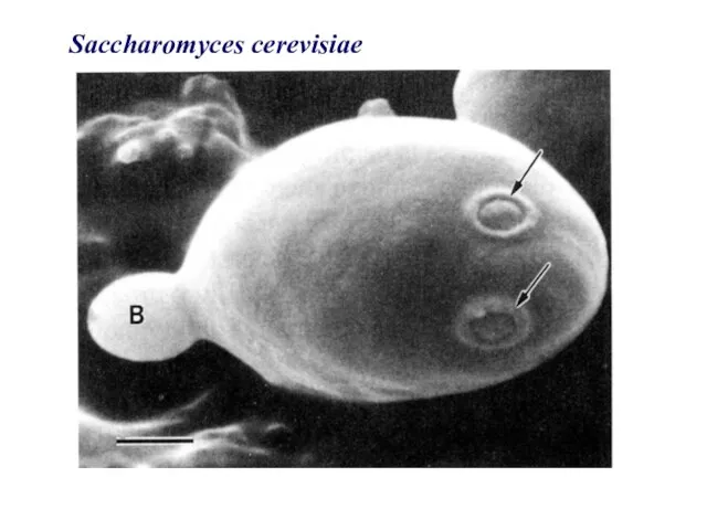 Saccharomyces cerevisiae