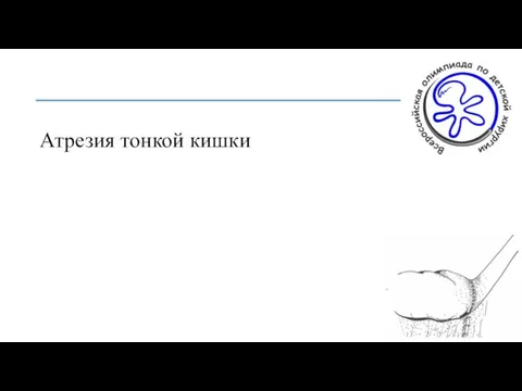 Атрезия тонкой кишки